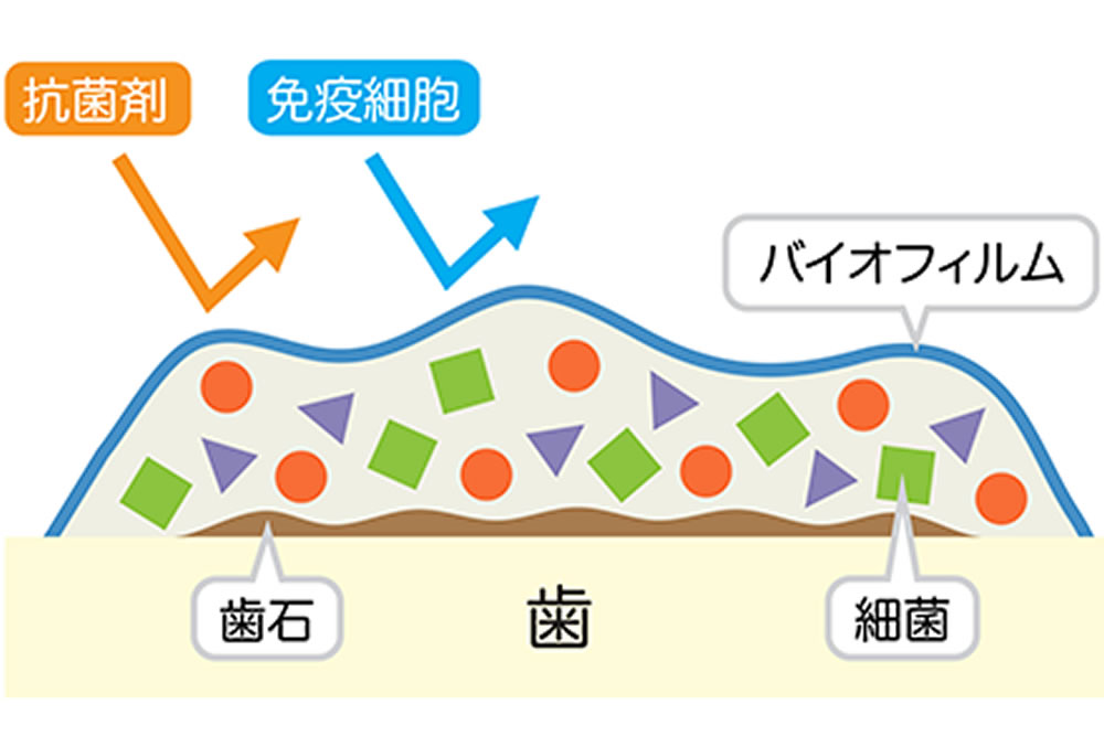 二子玉川の歯医者、大熊歯科医院の予防歯科