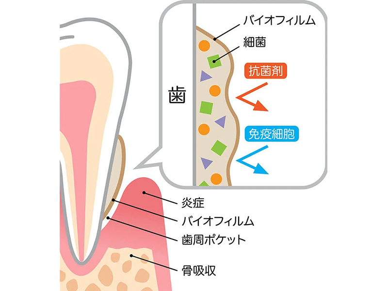 二子玉川の歯医者、大熊歯科医院の予防歯科