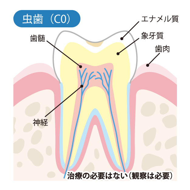 二子玉川の歯医者、大熊歯科医院で虫歯治療