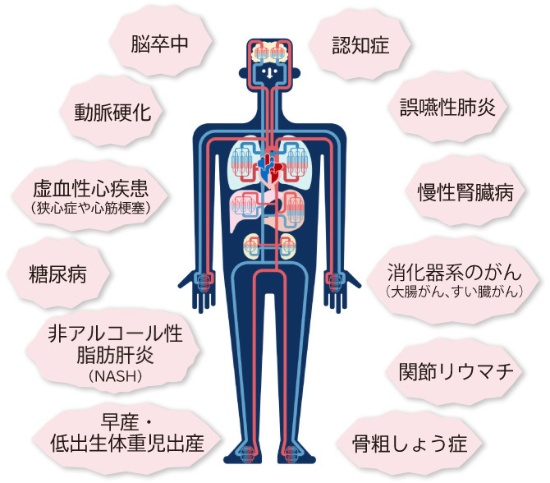 二子玉川の歯医者、大熊歯科医院の歯周病治療