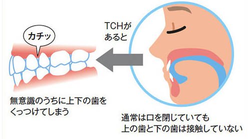 二子玉川の歯医者、大熊歯科医院の顎関節症治療