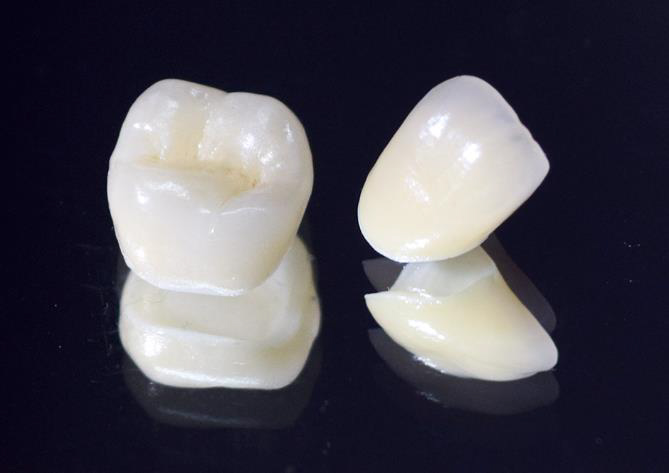 審美歯科 - 二子玉川の歯医者、大熊歯科医院